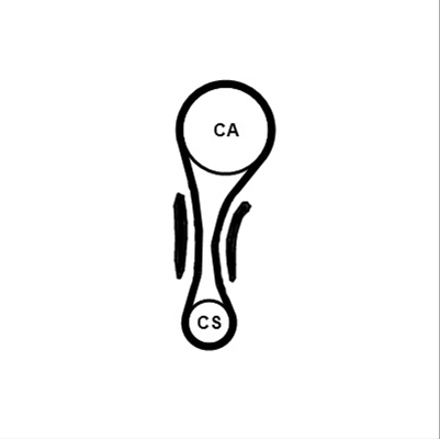 KIT CUREA DISTRIBUTIE